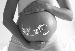Risarcimento danni per malformazioni alla nascita
