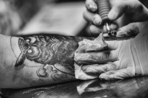 Risarcimento danni per tatuaggio con danno estetico